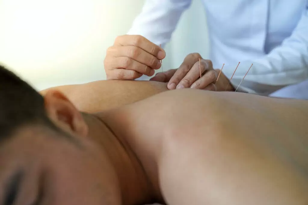 YOU Could Find Relief with Our Dry Needling Services