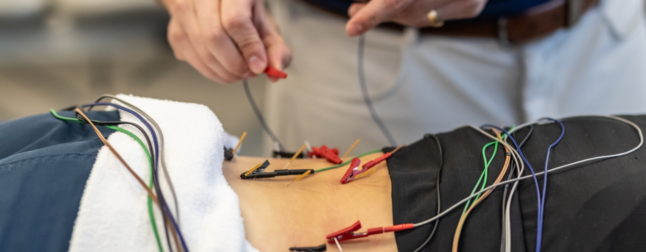dry-needling-1-taylor-rehab-Mooresville-NC